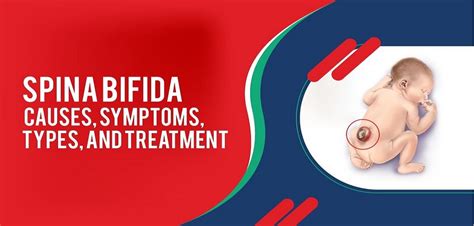 Spina bifida causes, symptoms and treatment